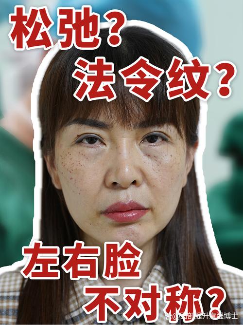 赤峰颞部除皱盘点：2026年价格、技术及正规机构选择全解析