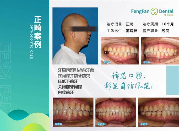 三明牙齿矫正排行榜单:2026年正规机构价格、正畸方案与医生 三明牙齿矫正排行榜单:2026年正规机构价格、正畸方案与医生