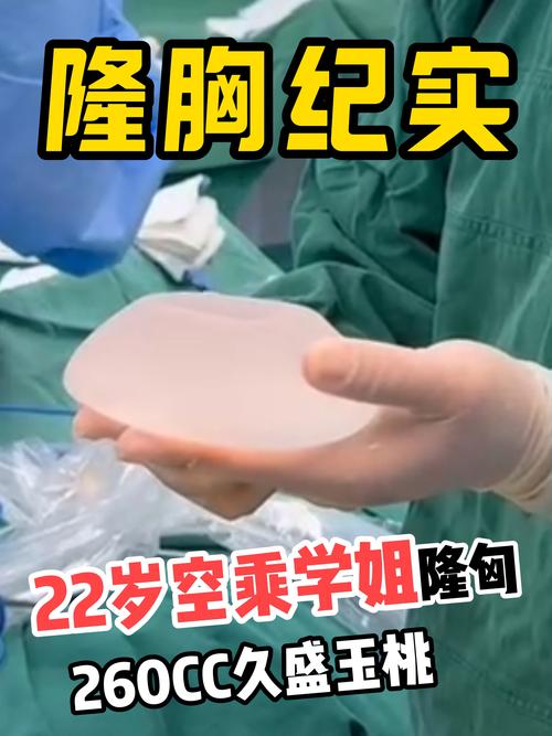 2026郴州假体隆胸正规指南:品牌选择、切口方式与恢复期全解