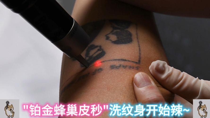 2026淮北皮秒洗纹身避坑指南：正规医院名单、价格参考与专业