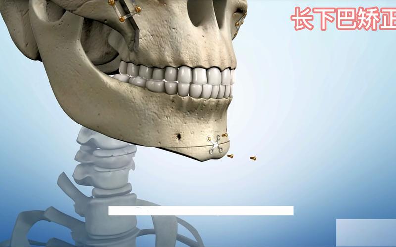 2026乐山下巴截骨口碑盘点:正规医院怎么选?价格费用参考