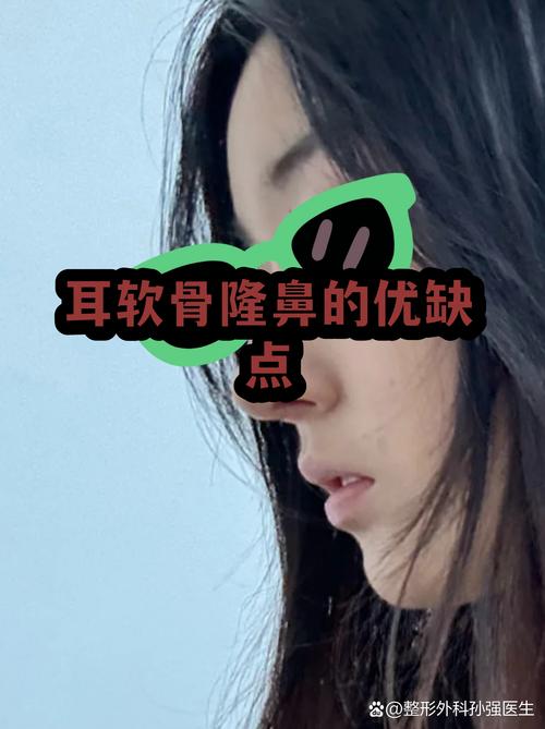焦作耳软骨隆鼻前3强推荐:揭秘价格、术式选择与避坑指南