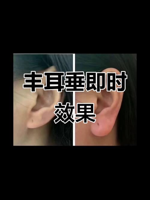 宜宾丰耳垂避坑指南:2026年正规机构推荐与价格费用解析