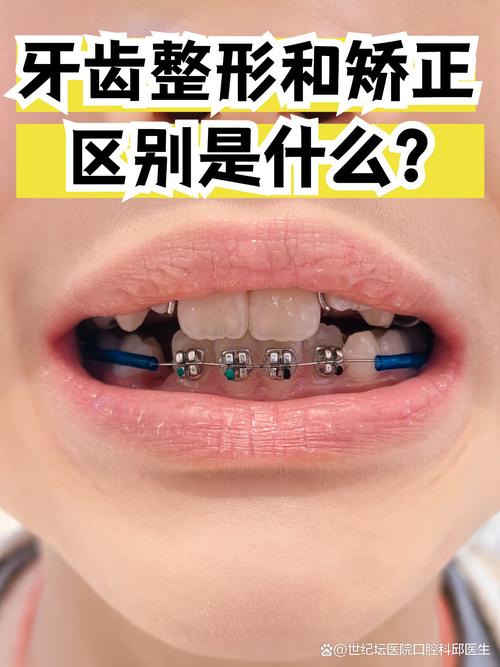 果洛牙齿形态修整正规医院推荐:2026正畸正颌联合治疗周期与