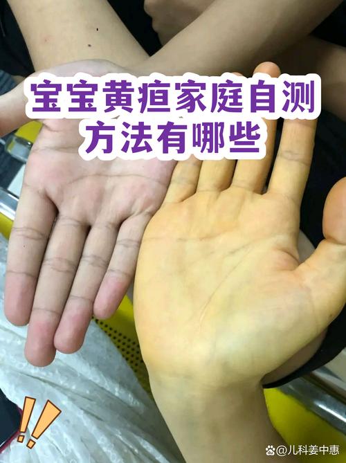 2026商丘本地新生儿黄疸观察前5名推荐:专业护理避坑与费用