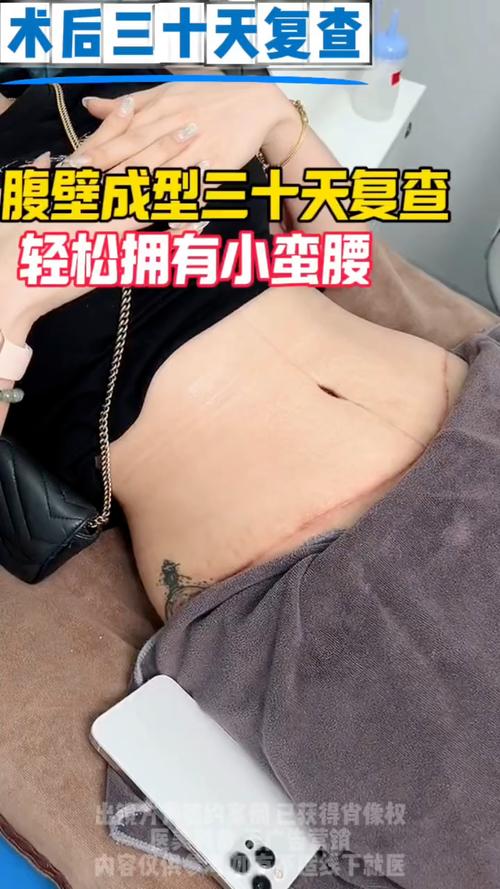 长沙腹壁成形专业哪家强？2026正规机构推荐与价格参考