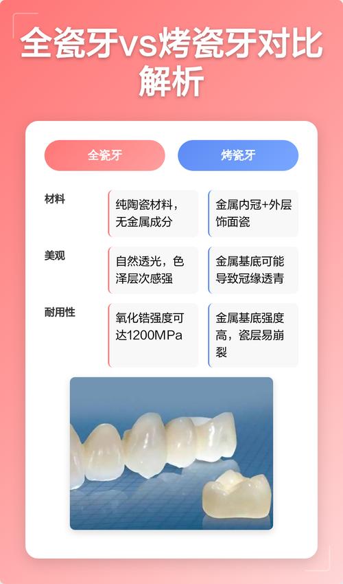 2026年庆阳全瓷牙怎么选?三大主流方案对比与正规医院避坑指