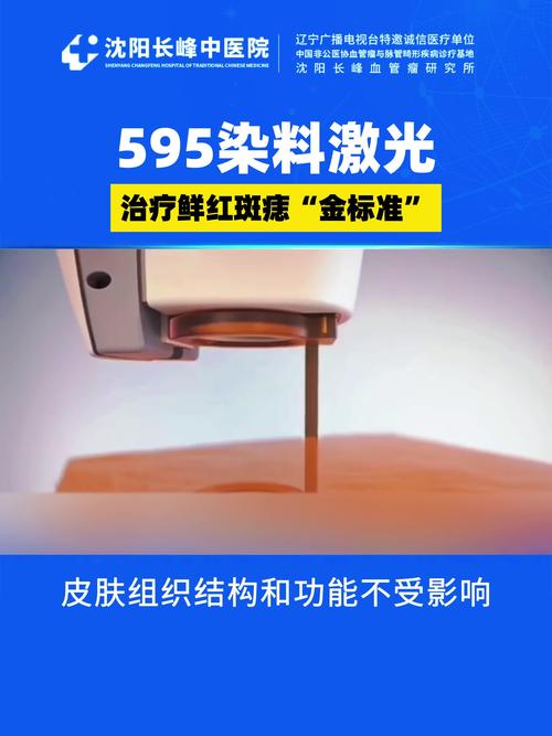 资阳胎记治疗多少钱?2026年价格参考与正规机构选择指南