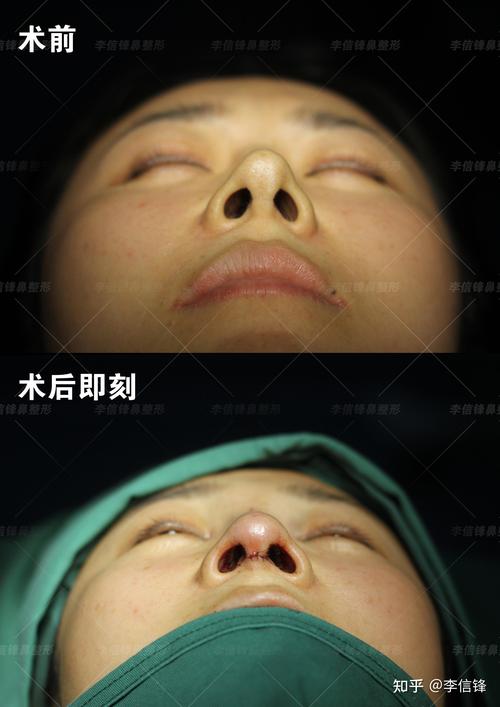 青岛鼻部修复哪家好?2026年TOP3机构盘点与价格参考