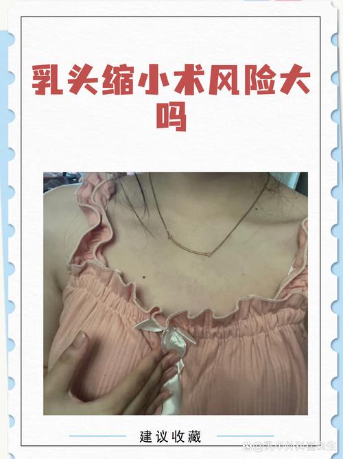 2026年吴忠乳头缩小前十强机构推荐:正规医院选择指南与价格