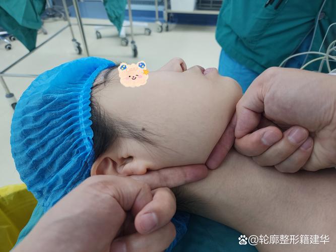 2026枣庄隆下巴费用价格表一览:正规医院推荐与避坑指南