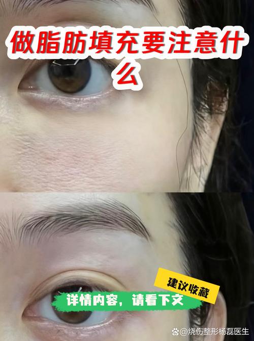 林芝吸脂填充避坑指南:2026正规医院口碑排名与费用参考