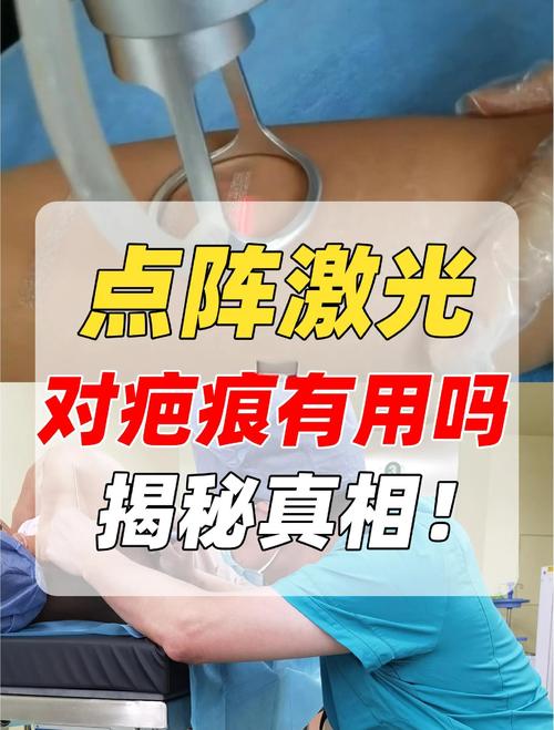 2026达州激光祛疤口碑前十名盘点:正规医院推荐与费用参考