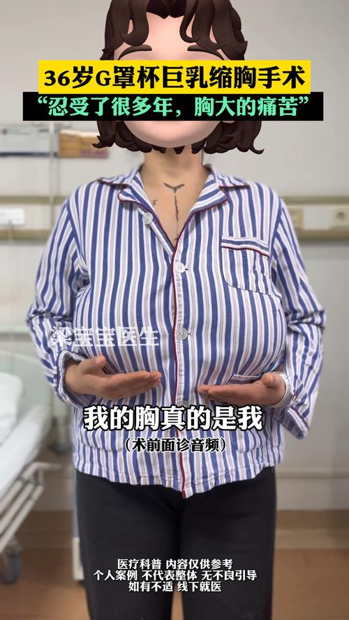 云浮巨乳缩小口碑怎么样?2026年云浮乳房缩小术正规医院推荐