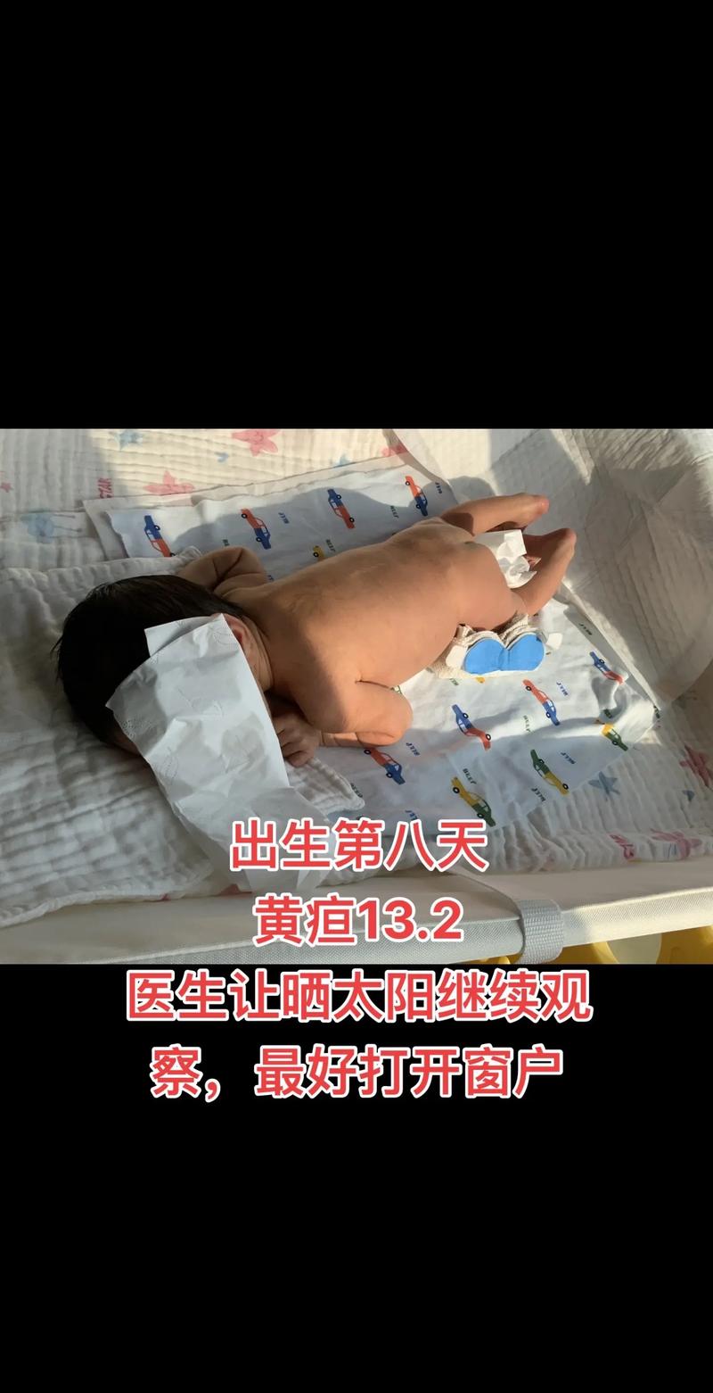 舟山本地新生儿黄疸观察盘点：正规服务机构与甄选指南